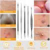 5 Pcs Blackhead Remover Kit Pimple Comedone Extractor Tool Set Stainless Steel - Black